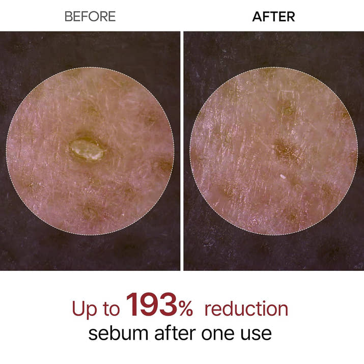 Glow Revive Black Rice Ampoule™